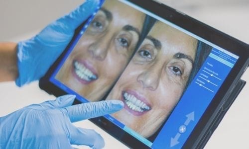 choosing the right cosmetic dentist