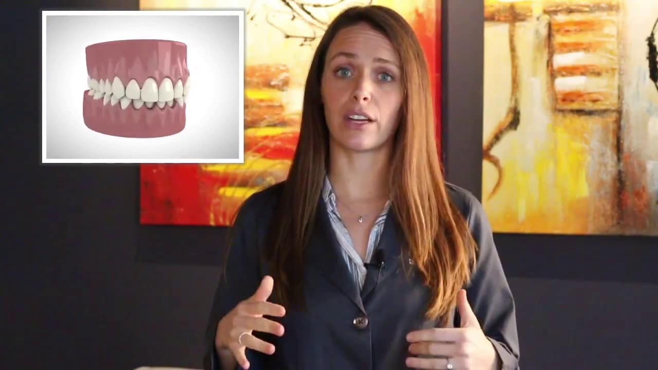 inman aligner