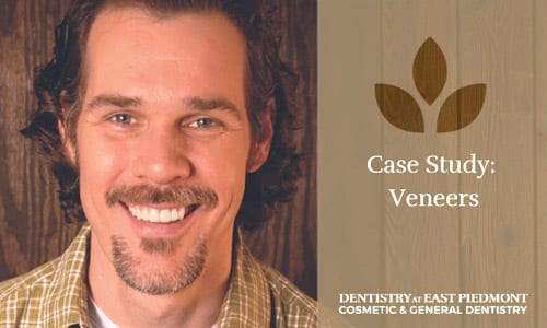 Jason's Veneers Case Study