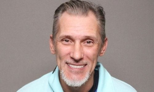Rob's complete dental restoration