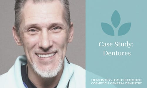 Rob's Implants Case Study