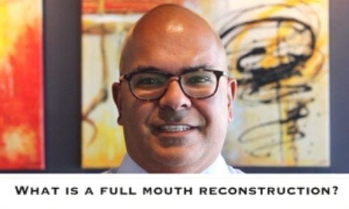 Full Mouth Reconstruction