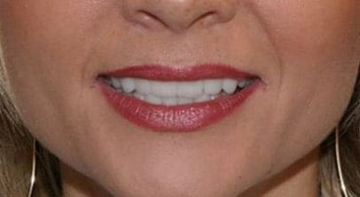 after arch makeover