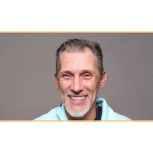 Rob – Life Changing Dentures for a renewed smile