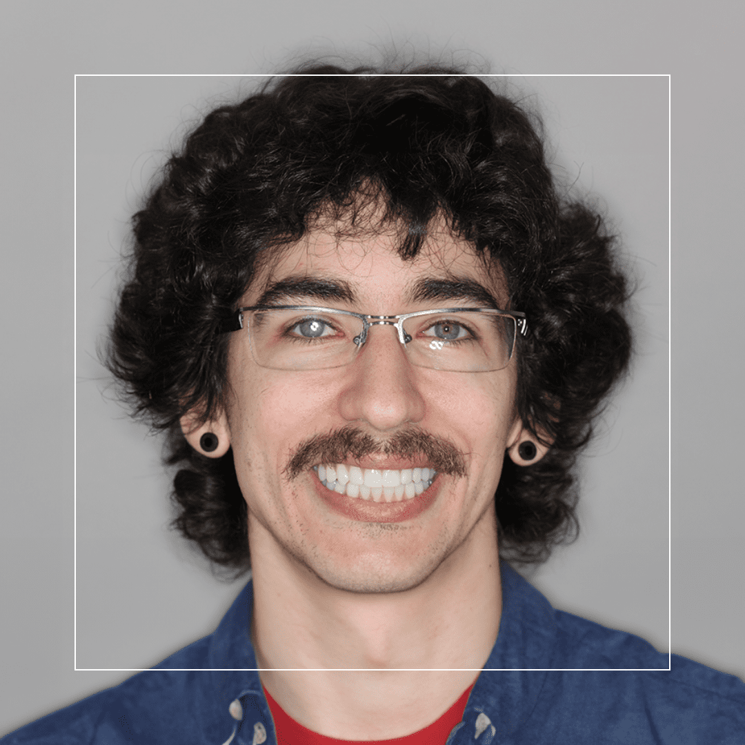 Teeth in a Day – Dillion